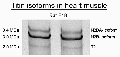 SDS-PAGE-Titin-isoform-rat-E18